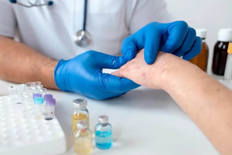 dermatologie